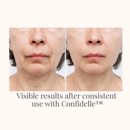 Confidelle™ UltraSonic Sculpt Pro