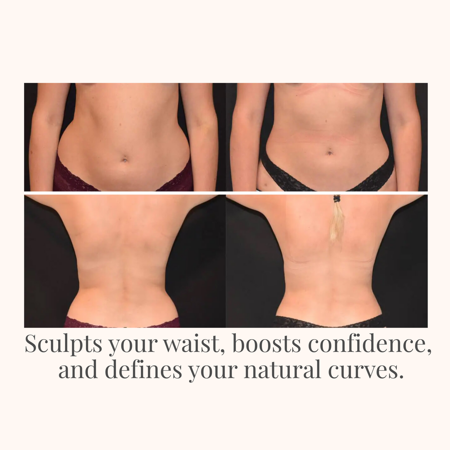 Confidelle™ SculptFit Waist Trainer