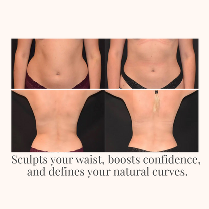 Confidelle™ SculptFit Waist Trainer